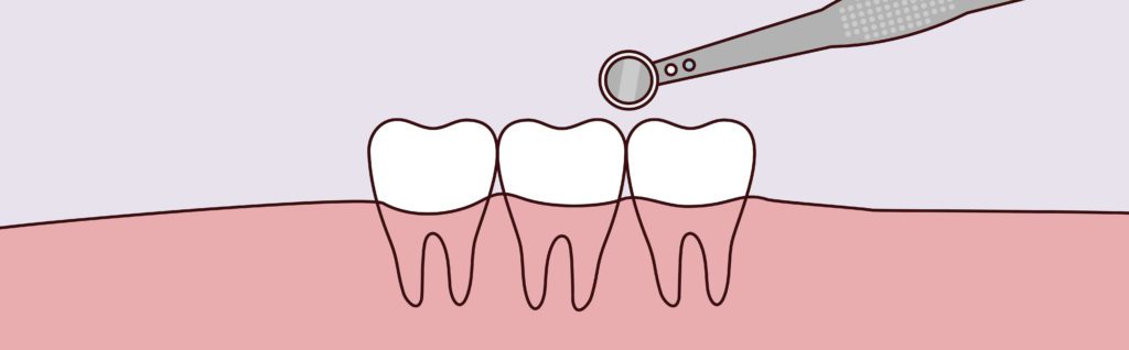 Pinecrest Dental | Endodontist Near Me South Jordan UT Endodontist South Jordan UT