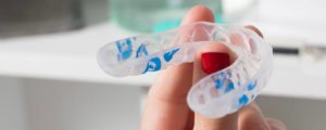 Pinecrest Dental | Mouth Guards for Teeth Grinding Dental Mouth-guard Service