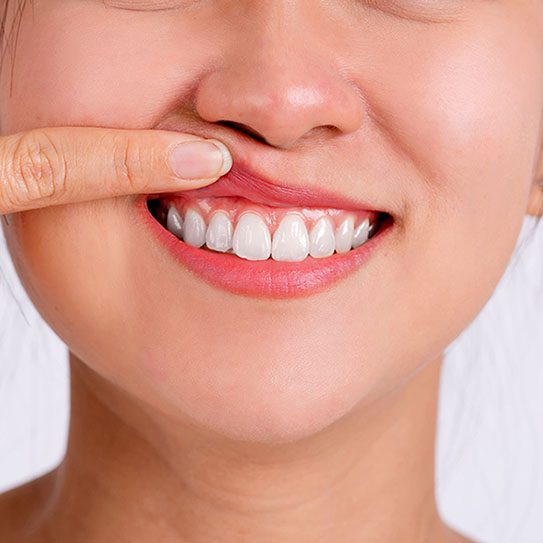 Gum Disease Treatment