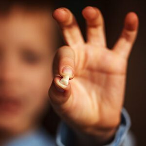 Pinecrest Dental- Dentist in Taylorsville | Baby Teeth Traditions in Other Cultures Dentist In Taylorsville